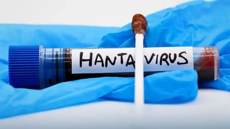 Hantavirus en France une patiente positive, 22 cas contact et une surveillance renforcée