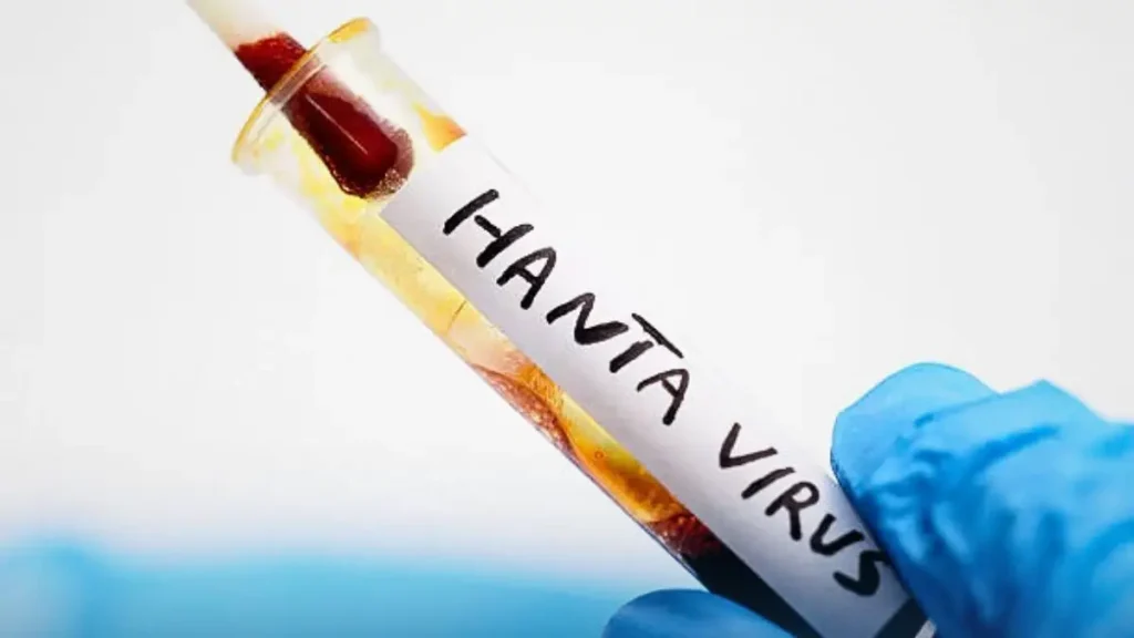 Hantavirus : la France active un dispositif sanitaire exceptionnel pour éviter toute propagation